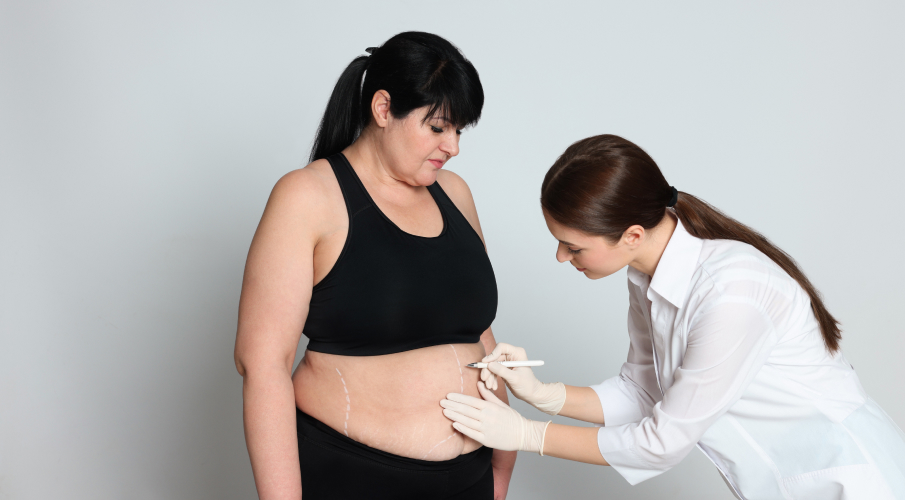 how-much-does-bariatric-surgery-cost