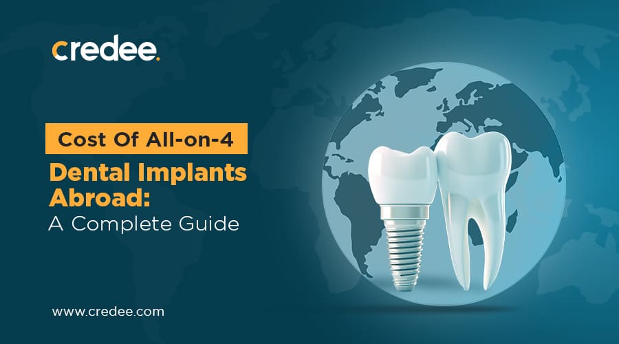 All-on-4 Dental Implants